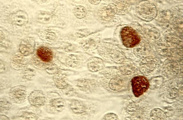 Chlamydia 
